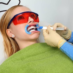 Woman receiving professional teeth whitening treatment