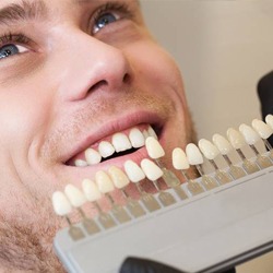 Young man’s smile compared with tooth color chart