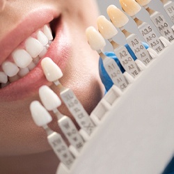 a dentist holding a color shade chart up to a patient’s smile