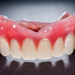 Traditional upper denture
