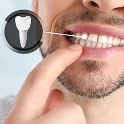 A closeup of a man pointing out his implanted tooth