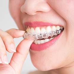 Woman removing Invisalign in Arlington from mouth