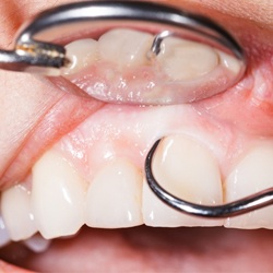 periodontal work