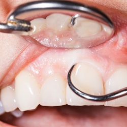 periodontal work