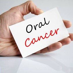 oral cancer