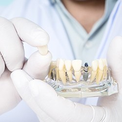 Man’s gloved hands showing how dental implants work
