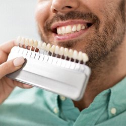 a man smiling before getting veneers in Arlington